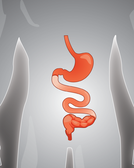 Bowel SBS Graphic Website